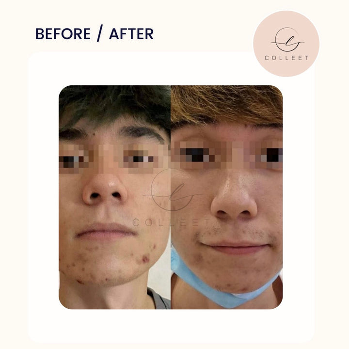COLLEET GLOW LT+ BEAUTY SUPPLEMENT [30 SACHETS]