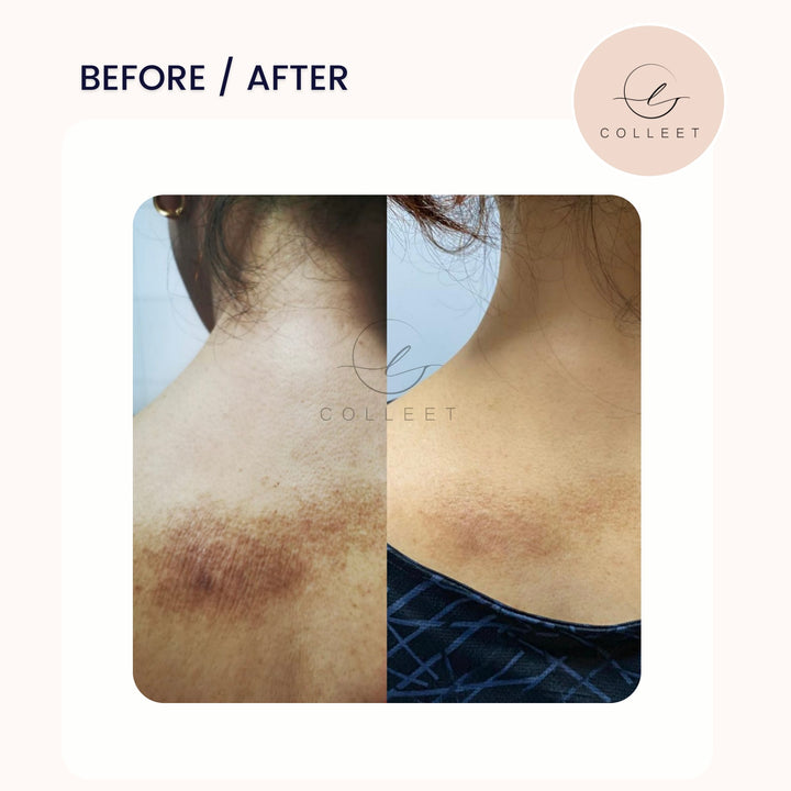 COLLEET GLOW LT+ BEAUTY SUPPLEMENT [30 SACHETS]
