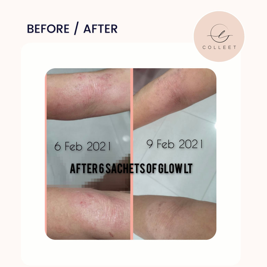 COLLEET GLOW LT+ BEAUTY SUPPLEMENT [30 SACHETS]