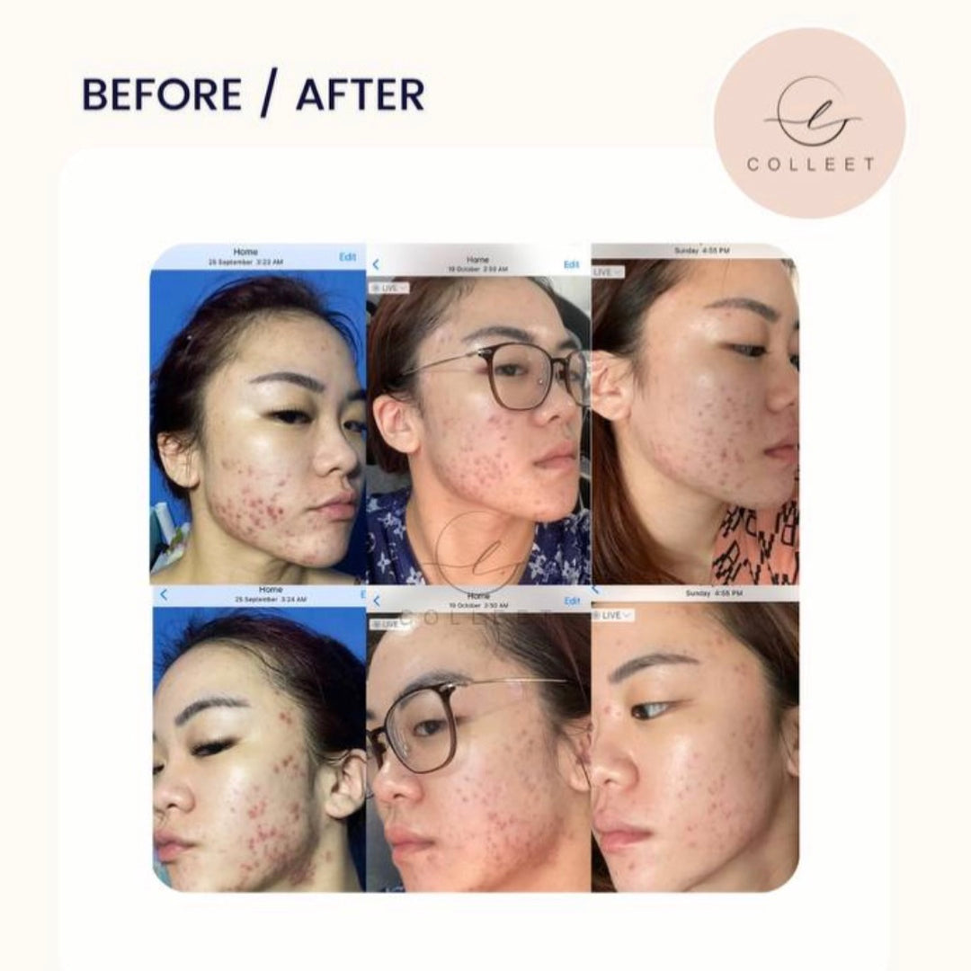 COLLEET GLOW LT+ BEAUTY SUPPLEMENT [30 SACHETS]