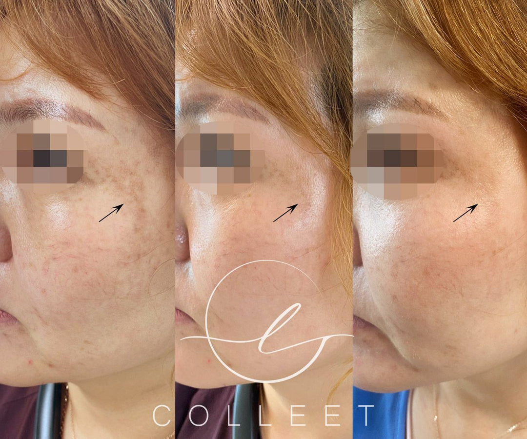 COLLEET GLOW LT+ BEAUTY SUPPLEMENT [30 SACHETS]
