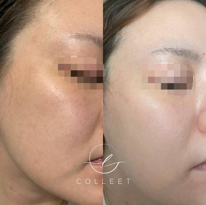 COLLEET GLOW LT+ BEAUTY SUPPLEMENT [30 SACHETS]