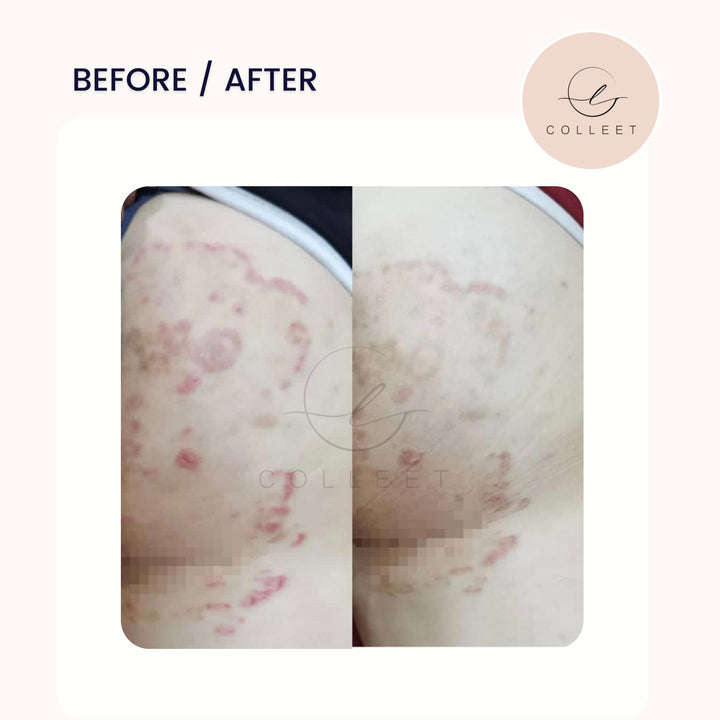 COLLEET GLOW LT+ BEAUTY SUPPLEMENT [30 SACHETS]